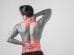 Hombre joven con dolor lumbar y cervical